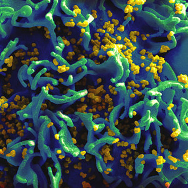 ВИЧ, медицина, «Вылеченный» от СПИДа ребенок снова болен